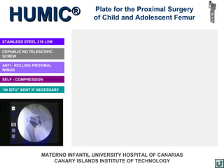 HUMIC                       ®    Plate for the Proximal Surgery
                                   of Child and Adolescent Femur


STAINLESS STEEL 316 LVM

CEPHALIC NO TELESCOPIC
SCREW

ANTI - ROLLING PROXIMAL
WINGS

SELF - COMPRESSION

“IN SITU” BENT IF NECESSARY




                  MATERNO INFANTIL UNIVERSITY HOSPITAL OF CANARIAS
                      CANARY ISLANDS INSTITUTE OF TECHNOLOGY
 