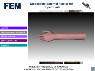 FEM                       Disposable External Fixator for
                                    Upper Limb




LIGHTER

EASIER SURGICAL TECHNIQUE

FRIENDLY DESIGN

CONSTANT QUALITY

CHEAPER




                          UNIVERSITY HOSPITAL OF CANARIAS
                       CANARY ISLANDS INSTITUTE OF TECHNOLOGY
 