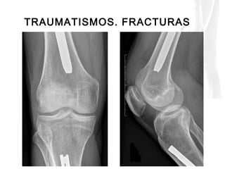 Ponencia Dra Cristina Méndez Díaz - Jornada de Actualización de ...
