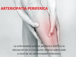 La enfermedad arterial periférica (EAP) es la
afectación de la circulación arterial sobre todo
a nivel de las extremidades inferiores.
ARTERIOPATIA PERIFERICA
 