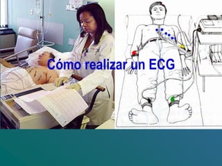 Cómo realizar un ECG
 