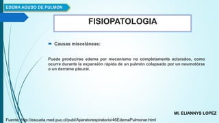 FISIOPATOLOGIA
 Causas misceláneas:
Puede producirse edema por mecanismo no completamente aclarados, como
ocurre durante la expansión rápida de un pulmón colapsado por un neumotórax
o un derrame pleural.
EDEMA AGUDO DE PULMON
MI. ELIANNYS LOPEZ
Fuente: http://escuela.med.puc.cl/publ/Aparatorespiratorio/46EdemaPulmonar.html
 