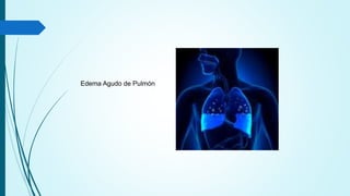 Edema Agudo de Pulmón
 