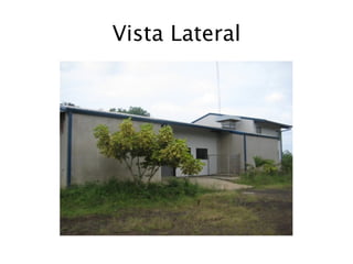 Vista Lateral
 
