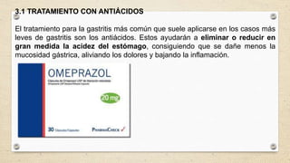 3.1 TRATAMIENTO CON ANTIÁCIDOS
El tratamiento para la gastritis más común que suele aplicarse en los casos más
leves de gastritis son los antiácidos. Estos ayudarán a eliminar o reducir en
gran medida la acidez del estómago, consiguiendo que se dañe menos la
mucosidad gástrica, aliviando los dolores y bajando la inflamación.
 