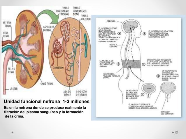 Necesidad de eliminacion