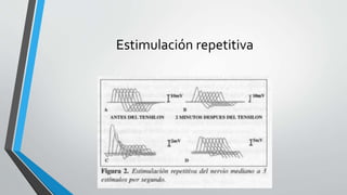 Estimulación repetitiva
 