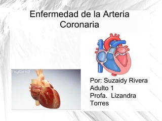 Enfermedad de la Arteria Coronaria ,[object Object]