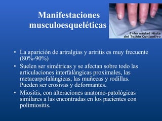 Manifestaciones musculoesqueléticas   La aparición de artralgias y artritis es muy frecuente (80%-90%) Suelen ser simétricas y se afectan sobre todo las articulaciones interfalángicas proximales, las metacarpofalángicas, las muñecas y rodillas. Pueden ser erosivas y deformantes.  Miositis, con alteraciones anatomo-patológicas similares a las encontradas en los pacientes con polimiositis.  