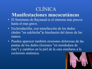 CLÍNICA Manifestaciones mucocutáneas   El fenómeno de Raynaud es el síntoma más precoz hasta el mas grave.  Esclerodactilia, con tumefacción de los dedos (dedos "en salchicha")e hinchazón del dorso de las manos. Pueden aparecer también erosiones dolorosas de las puntas de los dedos (lesiones "en mordedura de rata") y cambios en la piel de la cara similares a la esclerosis sistémica.  