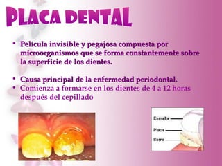 placa dental <ul><li>Película invisible y pegajosa compuesta por microorganismos que se forma constantemente sobre la supe...