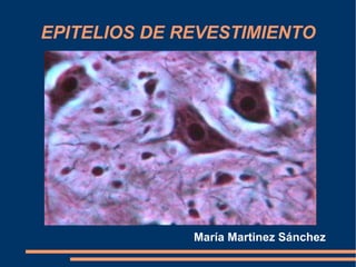 EPITELIOS DE REVESTIMIENTO María Martinez Sánchez 