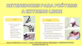Krol Rpi Design retenedores directos e indirectos | PDF