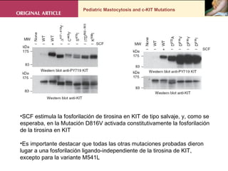 Pediatric Mastocytosis and c-KIT Mutations . Resultados SCF estimula la fosforilación de tirosina en KIT de tipo salvaje, y, como se esperaba, en la Mutación D816V activada constitutivamente la fosforilación de la tirosina en KIT Es importante destacar que todas las otras mutaciones probadas dieron lugar a una fosforilación ligando-independiente de la tirosina de KIT, excepto para la variante M541L 