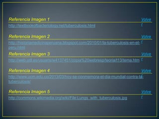 http://textbookofbacteriology.net/tuberculosis.html
Referencia Imagen 1 Volve
r
http://historiamedicinaperuana.blogspot.com/2010/01/la-tuberculosis-en-el-
peru.html
Referencia Imagen 2 Volve
r
http://web.udl.es/usuaris/w4137451/copia%20webresp/teoria/t13/tema.htm
Referencia Imagen 3 Volve
r
http://www.ucm.edu.co/2013/03/hoy-se-conmemora-el-dia-mundial-contra-la-
tuberculosis/
Referencia Imagen 4 Volve
r
http://commons.wikimedia.org/wiki/File:Lungs_with_tuberculosis.jpg
Referencia Imagen 5 Volve
r
 