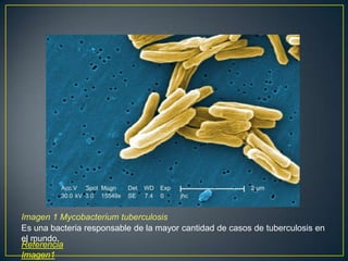 Imagen 1 Mycobacterium tuberculosis
Es una bacteria responsable de la mayor cantidad de casos de tuberculosis en
el mundo.
Referencia
Imagen1
 
