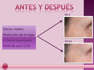 Efecto visible:
Reducción de arrugas
y Efecto suavizante
Nivel de uso: 2,5%
DÍA 0
DÍA 84
 