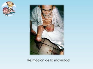 Restricción de la movilidad
 