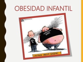 OBESIDAD INFANTIL
 