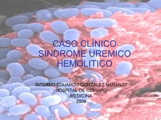 CASO CLÍNICO SINDROME UREMICO HEMOLITICO INTERNO EDUARDO GONZALEZ NARANJO HOSPITAL DE COPIAPO MEDICINA 2009 
