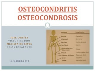 OSTEOCONDRITIS
        OSTEOCONDROSIS

  J O S E C O RT E Z
 VICTOR DE DIOS
MELISSA DE GIVES
KELSY ESCALANTE




  14.MARZO.2012
 