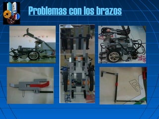 Problemas con los brazos
 