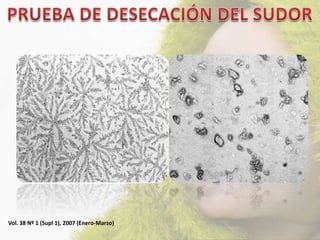 Vol. 38 Nº 1 (Supl 1), 2007 (Enero-Marzo)
 