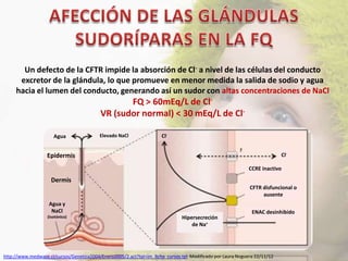 Un defecto de la CFTR impide la absorción de Cl- a nivel de las células del conducto
      excretor de la glándula, lo que promueve en menor medida la salida de sodio y agua
     hacia el lumen del conducto, generando así un sudor con altas concentraciones de NaCl
                                                  FQ > 60mEq/L de Cl-
                                           VR (sudor normal) < 30 mEq/L de Cl-

                      Agua                Elevado NaCl                Cl-


                   Epidermis                                                                                               Cl-

                                                                                                             CCRE inactivo

                     Dermis
                                                                                                             CFTR disfuncional o
                                                                                                                  ausente
                    Agua y
                     NaCl                                                                                     ENAC desinhibido
                   (Isotónico)                                                 Hipersecreción
                                                                                   de Na+




http://www.medwave.cl/cursos/Genetica2004/Enero2005/2.act?tpl=im_ficha_cursos.tpl. Modificado por Laura Noguera 22/11/12
 