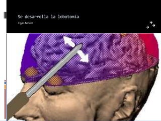 Se desarrolla la lobotomía
Egas Moniz
 