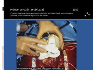 Primer corazón artificial                                                           1982
El primer corazón artificial permanente, diseñado por Robert Jarvik, se implanta a un
paciente, el cual sobrevive algo más de tres meses.
 