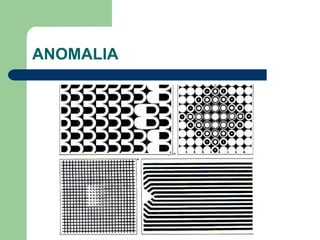 ANOMALIA
 