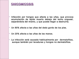  Infección por hongos que afecta a las uñas, que provoca
acumulación de tejido muerto debajo del lecho ungueal,
separándola del mismo, y que puede llegar a destruirla.
 Un 80% afecta a las uñas del dedo gordo de los pies.
 Un 20% afecta a las uñas de las manos.
 La infección está causada habitualmente por dermatofitos,
aunque también por levaduras y hongos no dermatofitos.
ONICOMICOSIS
ONICOMICOSIS
 
