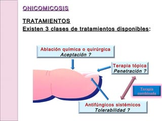 Ablación química o quirúrgica
Aceptación ?
Terapia tópica
Penetración ?
Antifúngicos sistémicos
Tolerabilidad ?
Terapia
combinada
ONICOMICOSIS
ONICOMICOSIS
TRATAMIENTOS
TRATAMIENTOS
Existen 3 clases de tratamientos disponibles
Existen 3 clases de tratamientos disponibles :
:
 