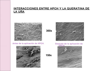 Antes de la aplicación de HPCH Después de la aplicación de
HPCH
360x
150x
INTERACCIONES ENTRE HPCH Y LA QUERATINA DE
INTERACCIONES ENTRE HPCH Y LA QUERATINA DE
LA UÑA
LA UÑA
 