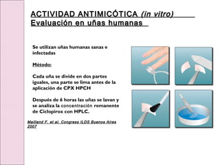 Se utilizan uñas humanas sanas e
infectadas
Método:
Cada uña se divide en dos partes
iguales, una parte se lima antes de la
aplicación de CPX HPCH
Después de 6 horas las uñas se lavan y
se analiza la concentración remanente
de Ciclopirox con HPLC.
Mailland F. et al. Congress ILDS Buenos Aires
Mailland F. et al. Congress ILDS Buenos Aires
2007
2007
ACTIVIDAD ANTIMICÓTICA
ACTIVIDAD ANTIMICÓTICA (in vitro)
(in vitro)
Evaluación en uñas humanas
Evaluación en uñas humanas
 