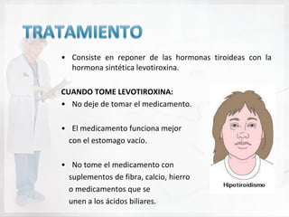 • Consiste en reponer de las hormonas tiroideas con la
  hormona sintética levotiroxina.

CUANDO TOME LEVOTIROXINA:
• No deje de tomar el medicamento.

• El medicamento funciona mejor
  con el estomago vacío.

• No tome el medicamento con
  suplementos de fibra, calcio, hierro
  o medicamentos que se
  unen a los ácidos biliares.
 