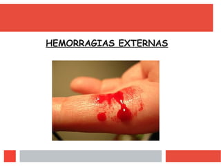 HEMORRAGIAS EXTERNAS
 
