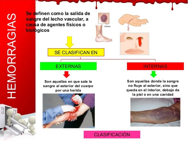 La hernia en sheynom el departamento el tratamiento por los modos públicos