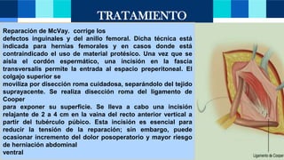 Mcvay Incision Presentacion hernias de la pared.pptx