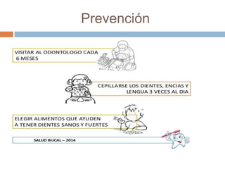 Prevención 
 