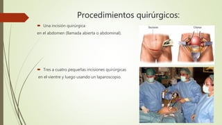 Procedimientos quirúrgicos:
 Una incisión quirúrgica
en el abdomen (llamada abierta o abdominal).
 Tres a cuatro pequeñas incisiones quirúrgicas
en el vientre y luego usando un laparoscopio.
 