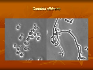 Candida albicans
 