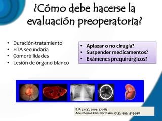 •   Duración-tratamiento
                                 • Aplazar o no cirugía?
•   HTA secundaria
                                 • Suspender medicamentos?
•   Comorbilidades
                                 • Exámenes prequirúrgicos?
•   Lesión de órgano blanco




                              BJA 92 (4), 2004: 570-83
                              Anesthesiol. Clin. North Am. 17(3),1999, ,529-548
 