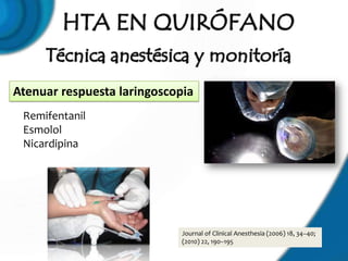 Atenuar respuesta laringoscopia
 Remifentanil
 Esmolol
 Nicardipina




                             Journal of Clinical Anesthesia (2006) 18, 34–40;
                             (2010) 22, 190–195
 