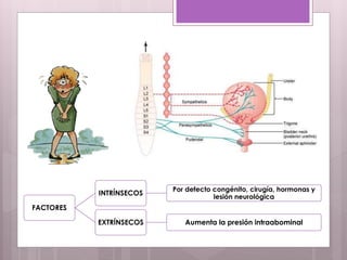 FACTORES
INTRÍNSECOS
Por defecto congénito, cirugía, hormonas y
lesión neurológica
EXTRÍNSECOS Aumenta la presión intraabominal
 