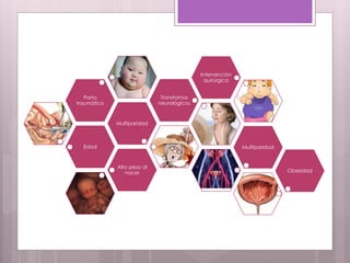 Edad
Multiparidad
Parto
traumático
Transtornos
neurológicos
Intervención
quirúrgica
Multiparidad
Alto peso al
nacer Obesidad
 