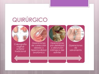QUIRÚRGICO
Colpografía
vaginal
anterior
tradicional
Operaciones
de corrección
debida a
hipermovilidad
anatómica
Operaciones
por debilidad
o disfunción
intrínseca del
esfínter
Operaciones
de
salvamento
 