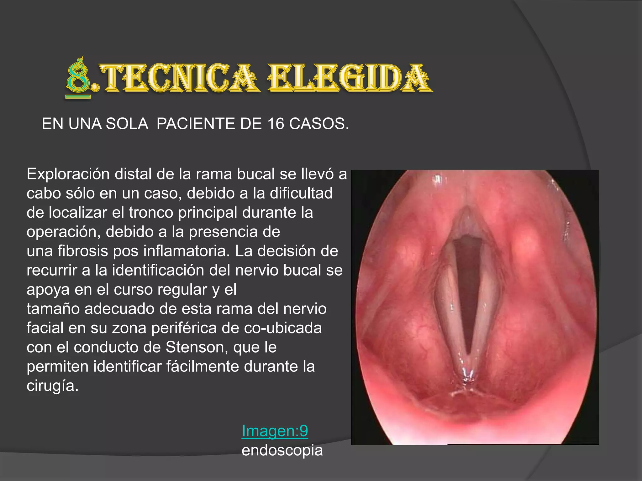 EN UNA SOLA PACIENTE DE 16 CASOS.


Exploración distal de la rama bucal se llevó a
cabo sólo en un caso, debido a la dificultad
de localizar el tronco principal durante la
operación, debido a la presencia de
una fibrosis pos inflamatoria. La decisión de
recurrir a la identificación del nervio bucal se
apoya en el curso regular y el
tamaño adecuado de esta rama del nervio
facial en su zona periférica de co-ubicada
con el conducto de Stenson, que le
permiten identificar fácilmente durante la
cirugía.

                                Imagen:9
                                endoscopia
 