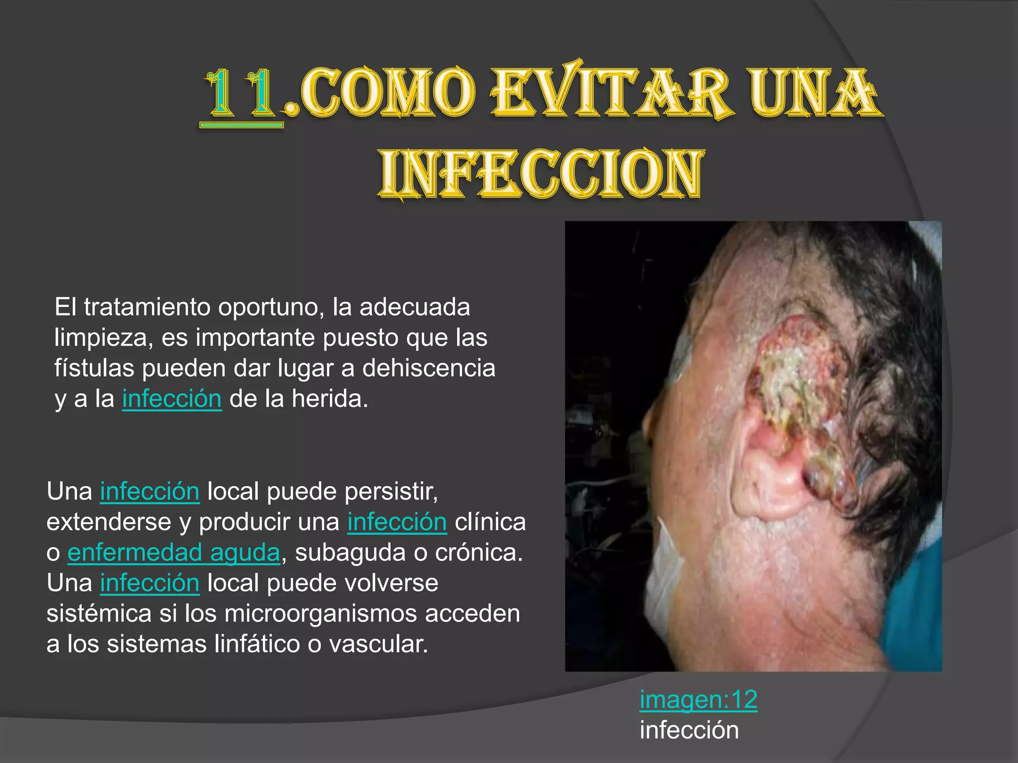 El tratamiento oportuno, la adecuada
limpieza, es importante puesto que las
fístulas pueden dar lugar a dehiscencia
y a la infección de la herida.


Una infección local puede persistir,
extenderse y producir una infección clínica
o enfermedad aguda, subaguda o crónica.
Una infección local puede volverse
sistémica si los microorganismos acceden
a los sistemas linfático o vascular.

                                              imagen:12
                                              infección
 