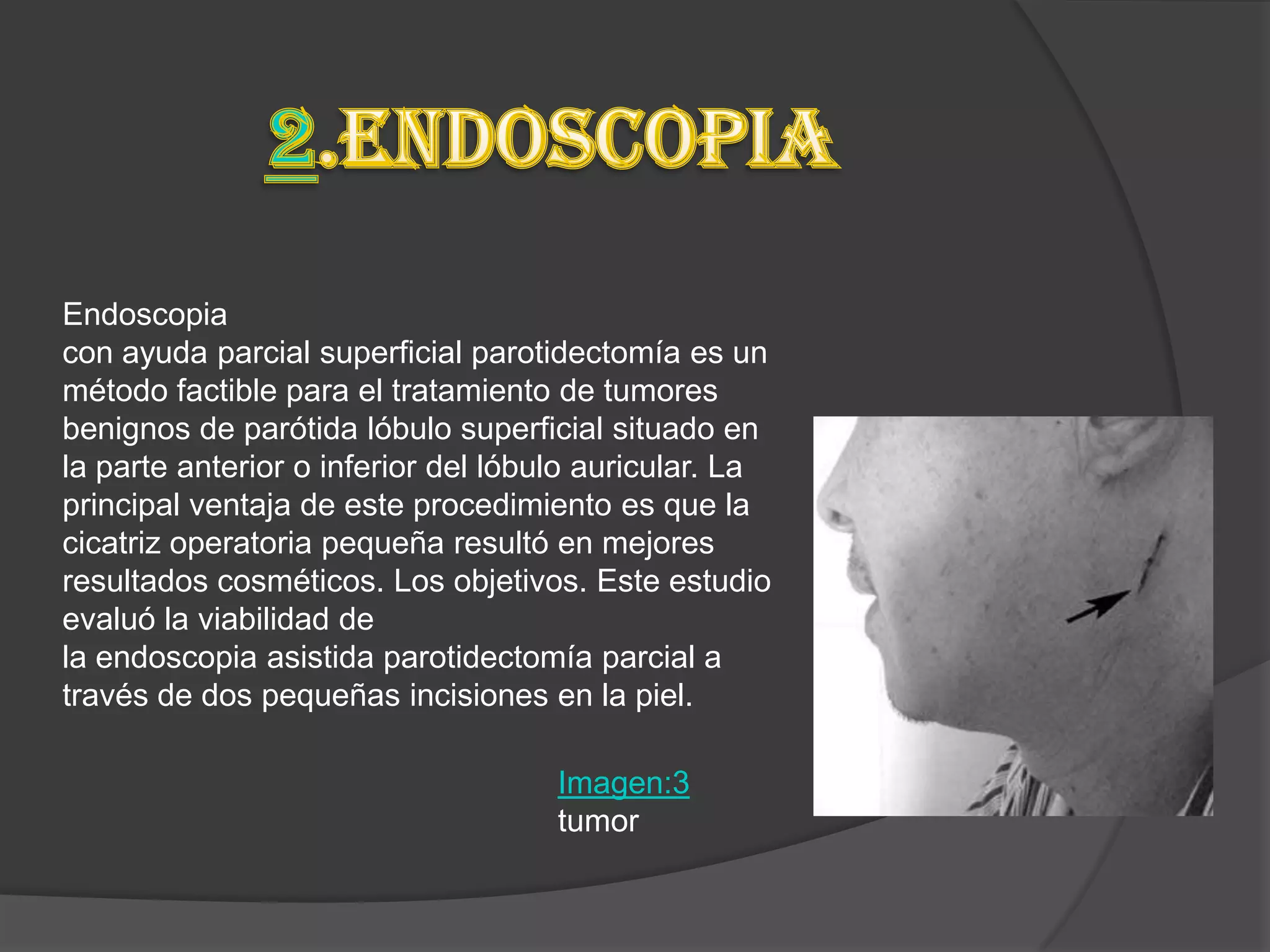 Endoscopia
con ayuda parcial superficial parotidectomía es un
método factible para el tratamiento de tumores
benignos de parótida lóbulo superficial situado en
la parte anterior o inferior del lóbulo auricular. La
principal ventaja de este procedimiento es que la
cicatriz operatoria pequeña resultó en mejores
resultados cosméticos. Los objetivos. Este estudio
evaluó la viabilidad de
la endoscopia asistida parotidectomía parcial a
través de dos pequeñas incisiones en la piel.

                                     Imagen:3
                                     tumor
 
